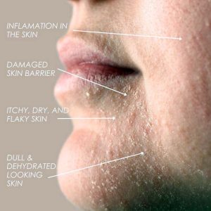 Understanding Skin Barrier and Why It Matters for Sensitive Skin