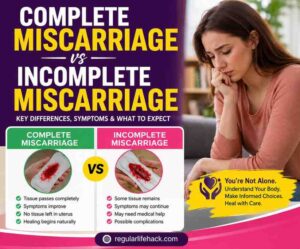 Complete Miscarriage vs Incomplete Miscarriage